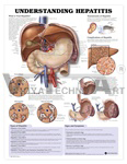 Understanding Hepatitis Anatomical Chart